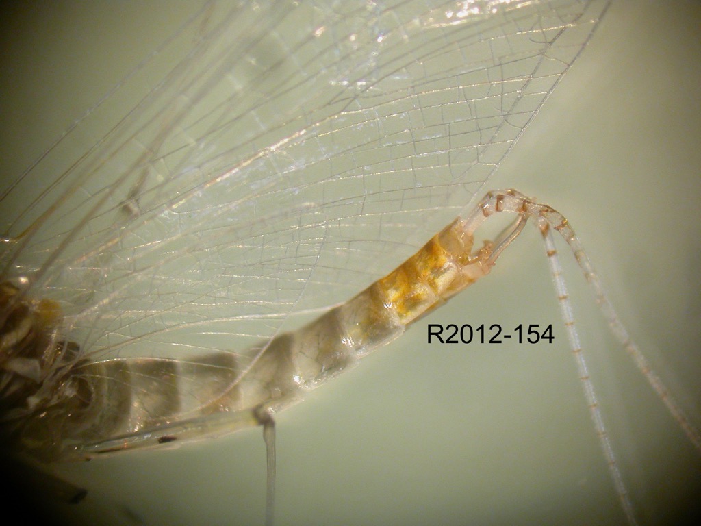 abdomen lateral