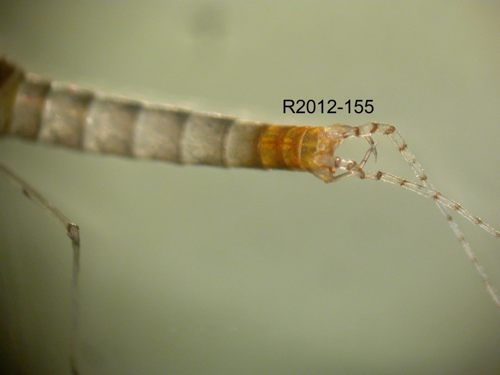 abdomen lateral