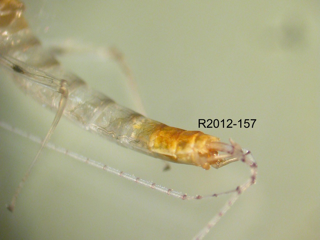 abdomen lateral