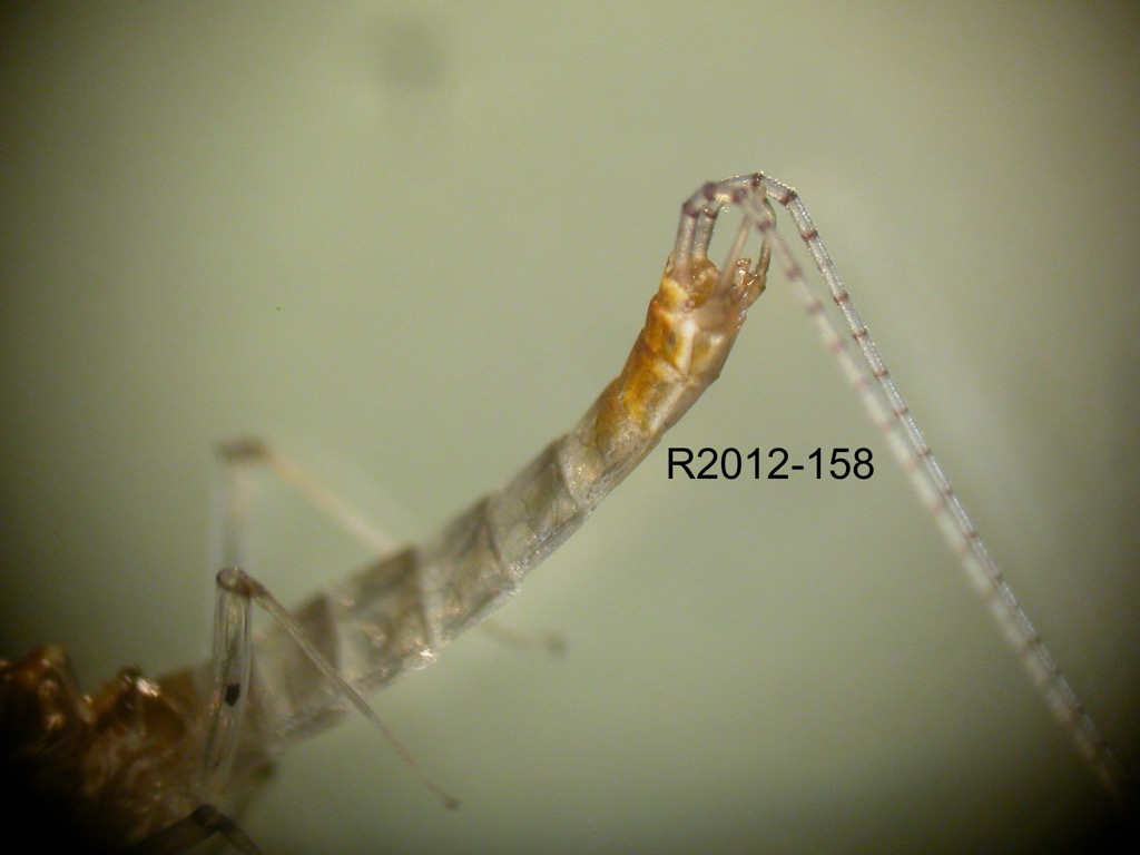 abdomen lateral
