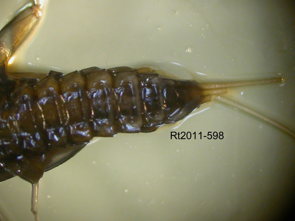abdomen ventral