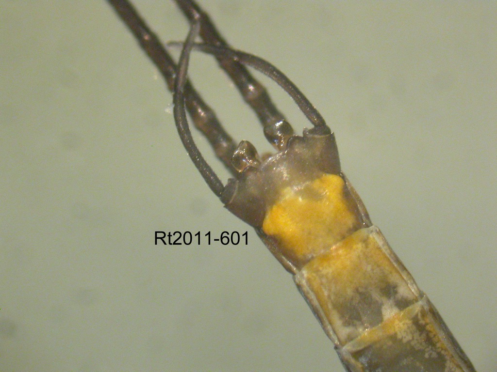 genitalia ventral