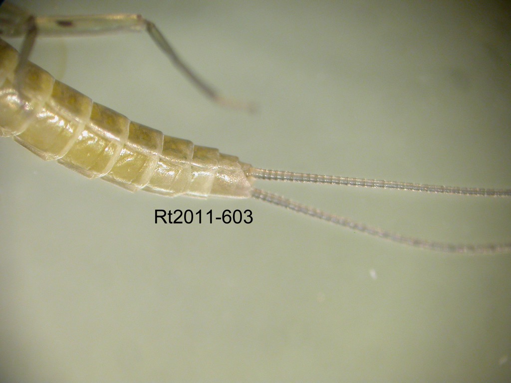 abdomen lateral