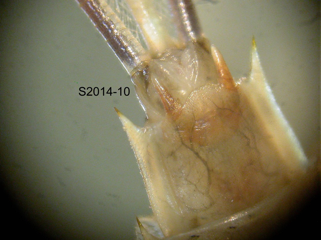abdominal apex ventral