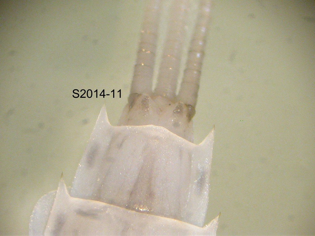 abdominal apex ventral