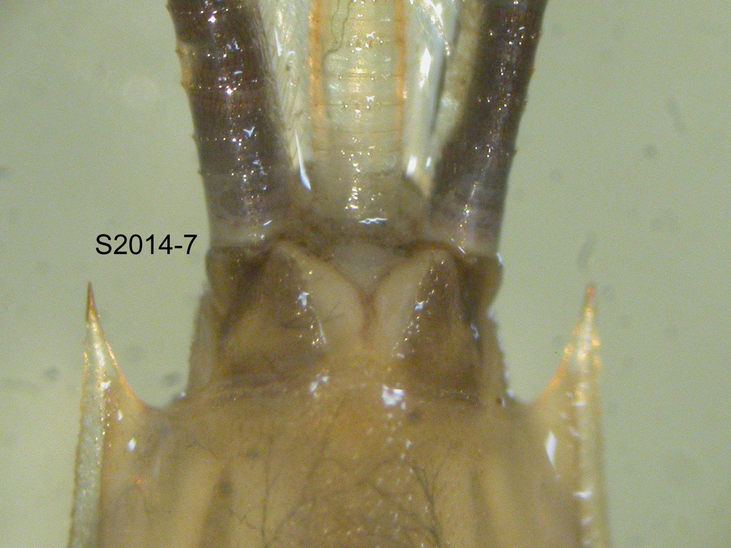abdominal apex ventral