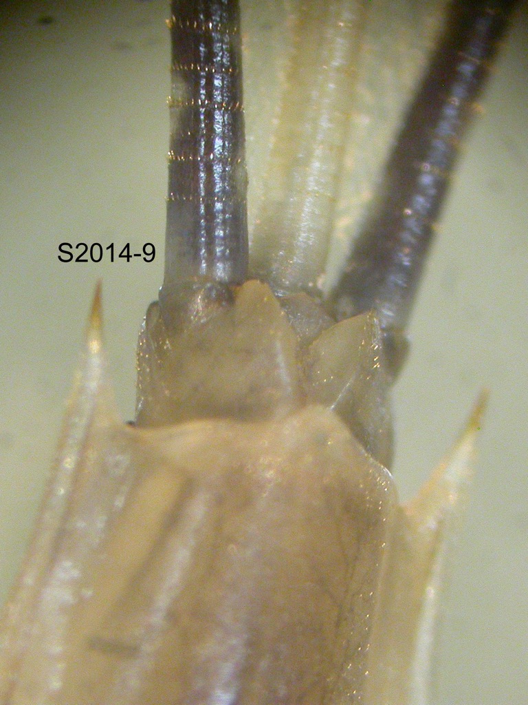 abdominal apex ventral